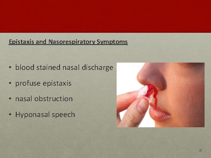 Epistaxis and Nasorespiratory Symptoms • blood stained nasal discharge • profuse epistaxis • nasal