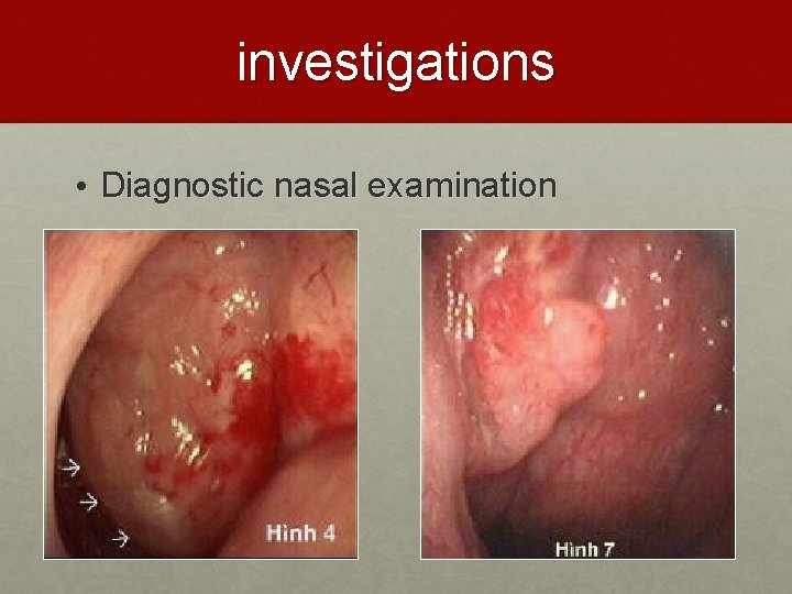investigations • Diagnostic nasal examination 