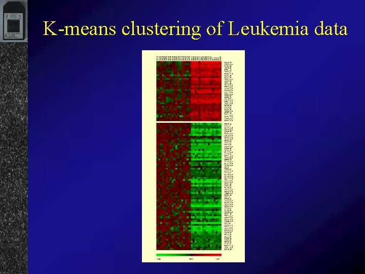 K-means clustering of Leukemia data 