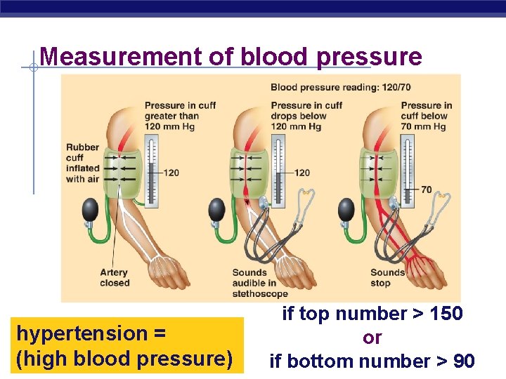 Measurement of blood pressure hypertension = (high blood pressure) Regents Biology if top number