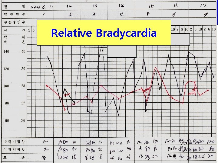 Relative Bradycardia 