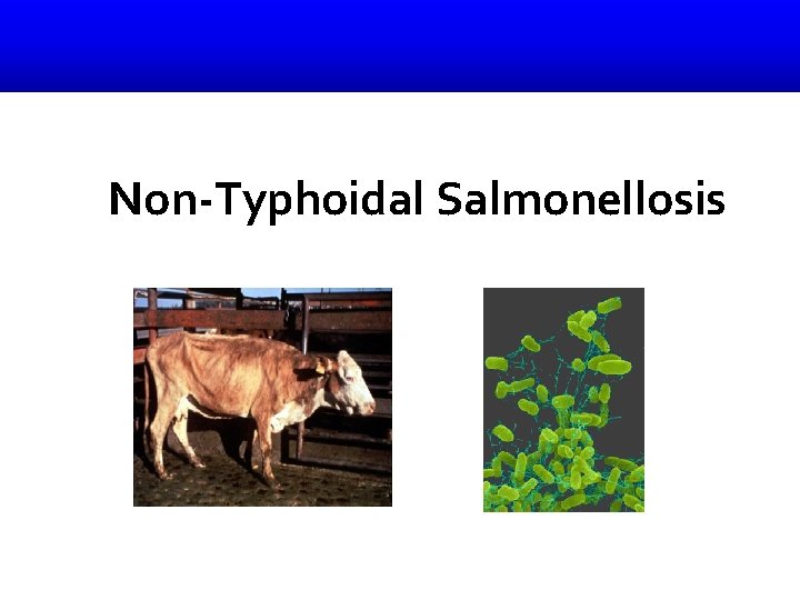 Non-Typhoidal Salmonellosis 