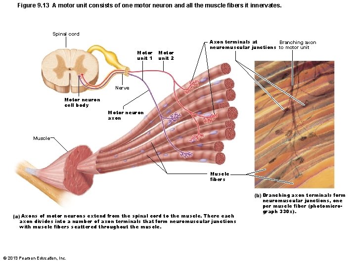 Figure 9. 13 A motor unit consists of one motor neuron and all the