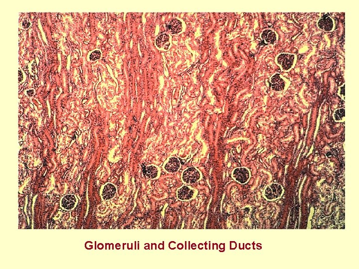  Glomeruli and Collecting Ducts 