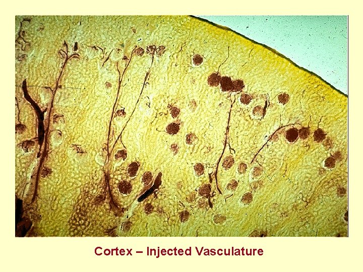 Cortex – Injected Vasculature 