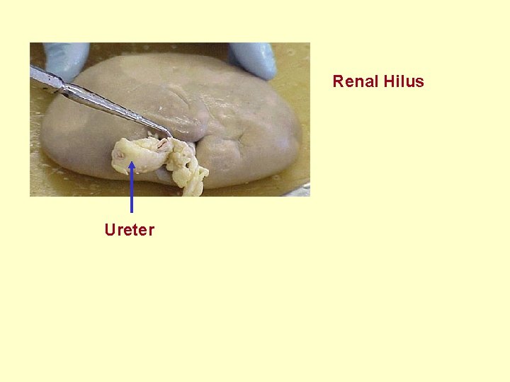 Renal Hilus Ureter 