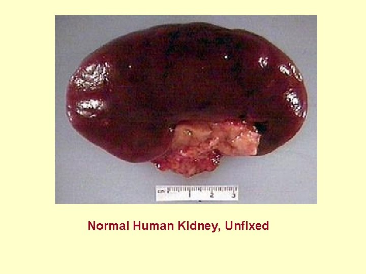 Normal Human Kidney, Unfixed 