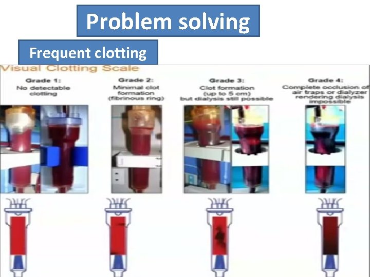 Problem solving Frequent clotting Clotting during dialysis • blood becomes very dark in circuit