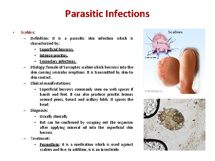 Parasitic Infections • Scabies: – Definition: it is a parasitic skin infection which is