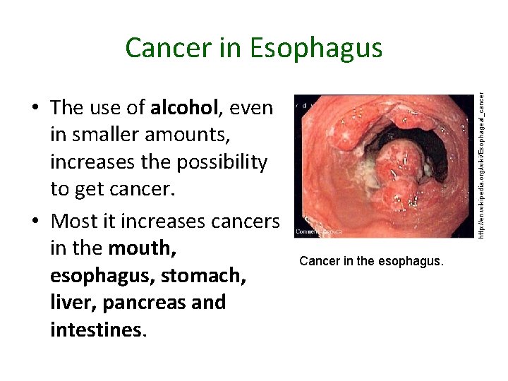 • The use of alcohol, even in smaller amounts, increases the possibility to