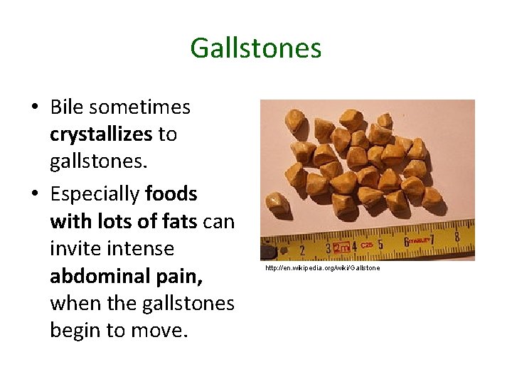 Gallstones • Bile sometimes crystallizes to gallstones. • Especially foods with lots of fats