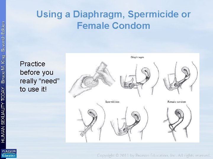 Using a Diaphragm, Spermicide or Female Condom Practice before you really “need” to use