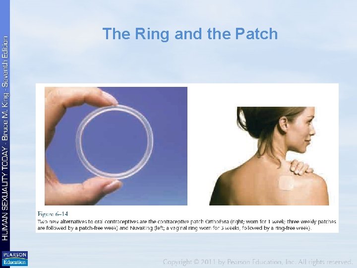 The Ring and the Patch 