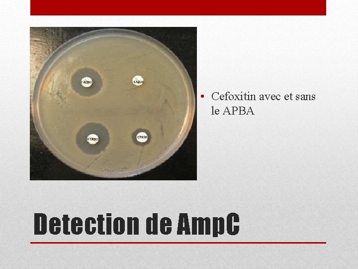  • Cefoxitin avec et sans le APBA Detection de Amp. C 