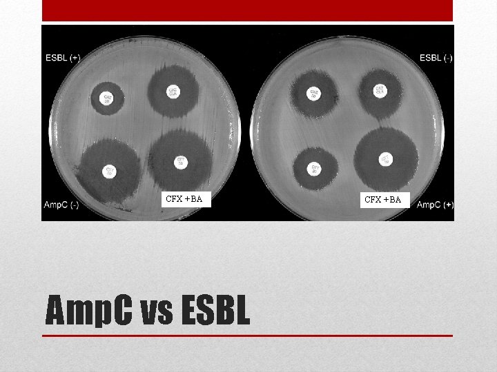 CFX + BA Amp. C vs ESBL CFX + BA 