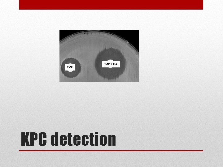 IMP + BA KPC detection 
