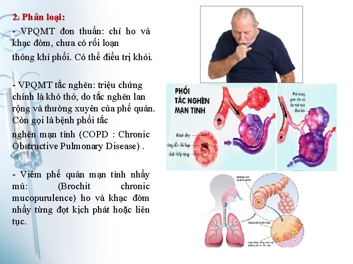 2. Phân loại: - VPQMT đơn thuần: chỉ ho và khạc đờm, chưa có