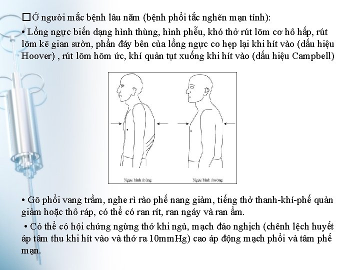 �Ở người mắc bệnh lâu năm (bệnh phổi tắc nghẽn mạn tính): • Lồng