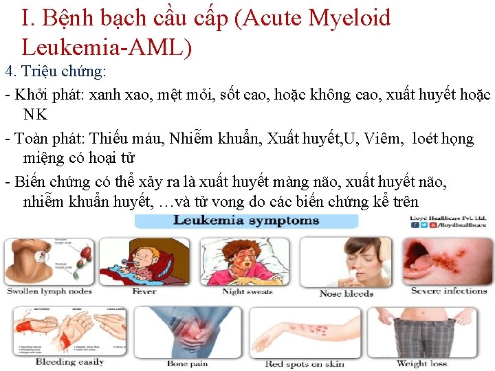 I. Bệnh bạch cầu cấp (Acute Myeloid Leukemia-AML) 4. Triệu chứng: - Khởi phát: