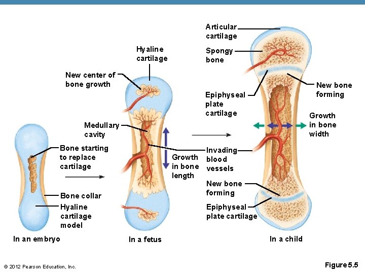 Articular cartilage Hyaline cartilage Spongy bone New center of bone growth New bone forming