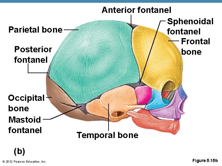 Parietal bone Posterior fontanel Occipital bone Mastoid fontanel Anterior fontanel Sphenoidal fontanel Frontal bone
