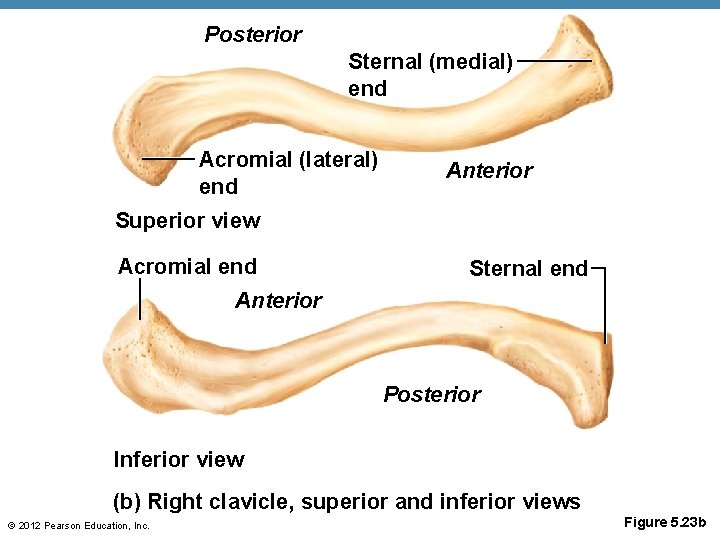 Posterior Sternal (medial) end Acromial (lateral) end Anterior Superior view Acromial end Sternal end