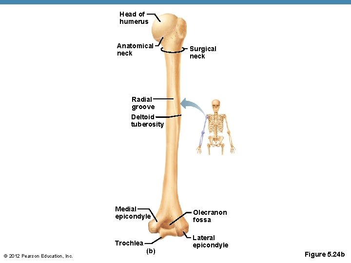 Head of humerus Anatomical neck Surgical neck Radial groove Deltoid tuberosity © 2012 Pearson