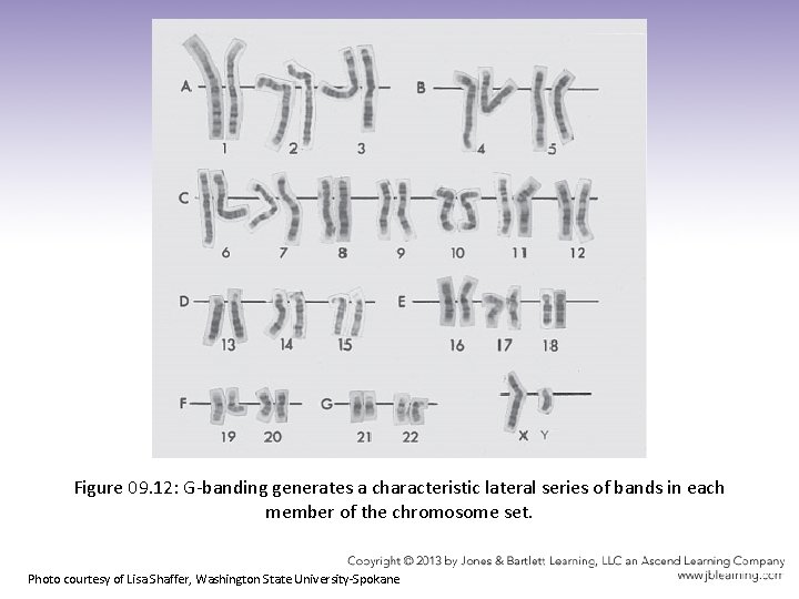 Figure 09. 12: G-banding generates a characteristic lateral series of bands in each member