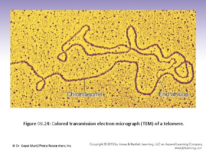 Figure 09. 24: Colored transmission electron micrograph (TEM) of a telomere. © Dr. Gopal