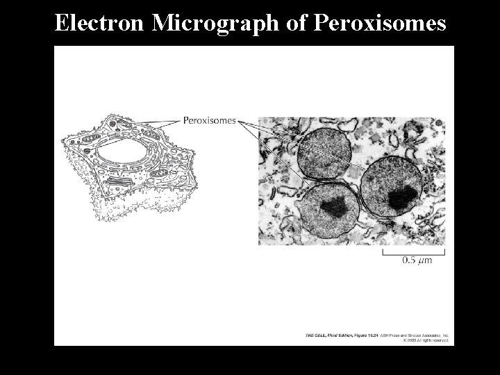 Electron Micrograph of Peroxisomes 