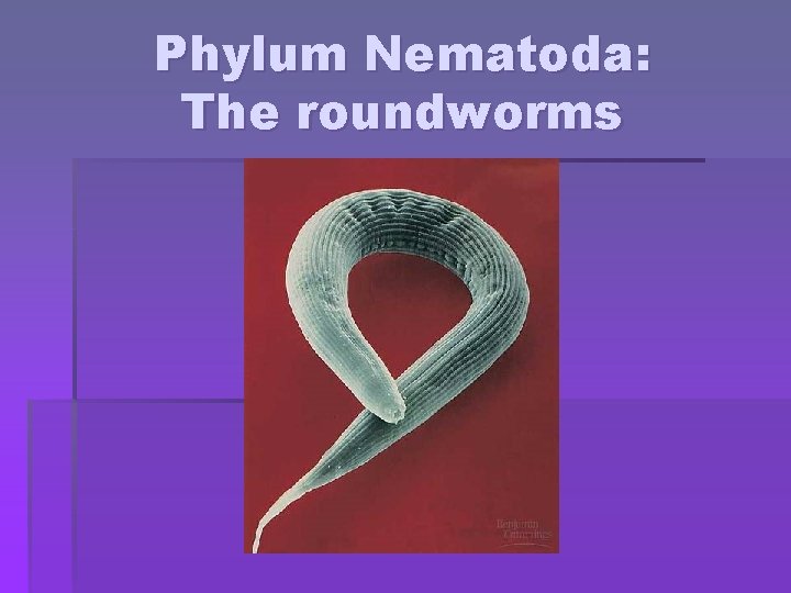 Phylum Nematoda: The roundworms 