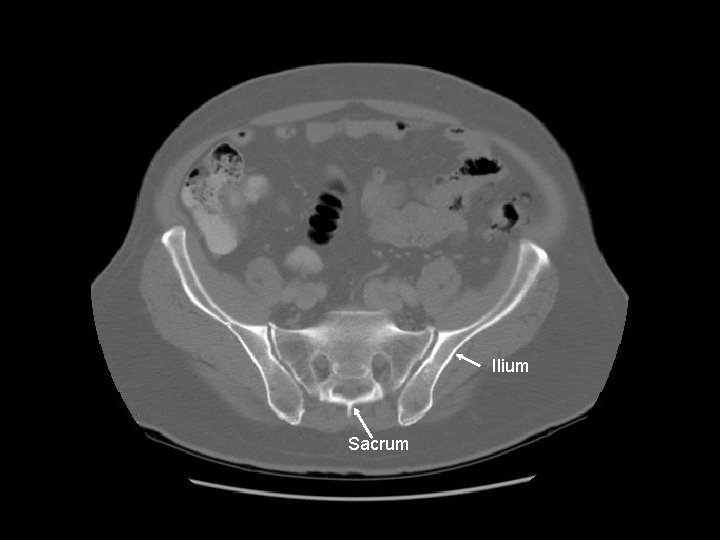 Ilium Sacrum 