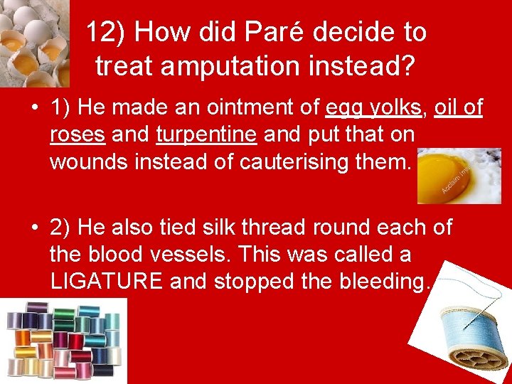 12) How did Paré decide to treat amputation instead? • 1) He made an