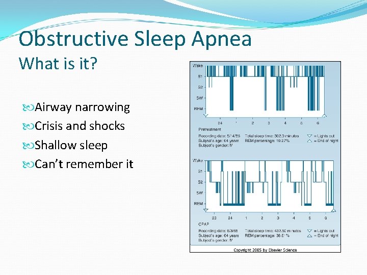 Obstructive Sleep Apnea What is it? Airway narrowing Crisis and shocks Shallow sleep Can’t