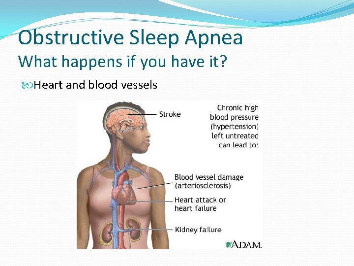 Obstructive Sleep Apnea What happens if you have it? Heart and blood vessels 