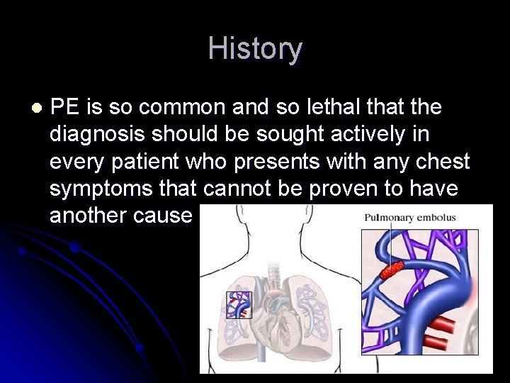 History l PE is so common and so lethal that the diagnosis should be