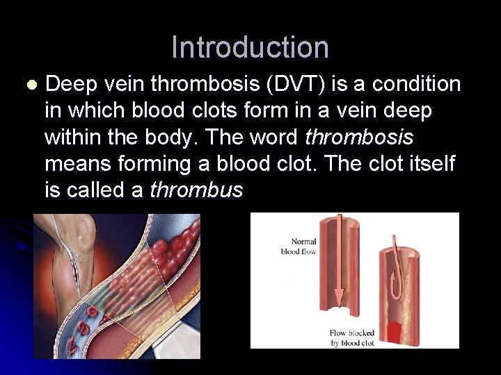 Introduction l Deep vein thrombosis (DVT) is a condition in which blood clots form