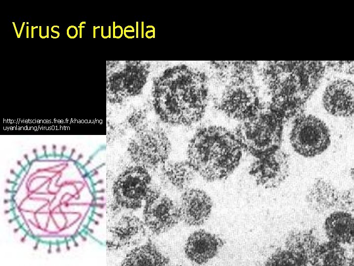 Virus of rubella http: //vietsciences. free. fr/khaocuu/ng uyenlandung/virus 01. htm 