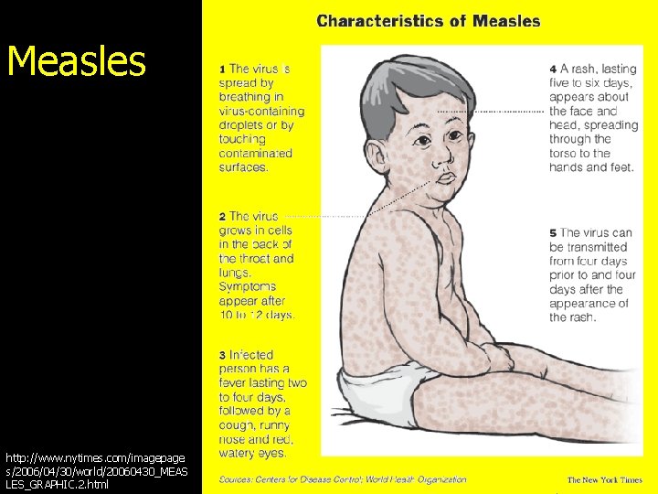 Measles http: //www. nytimes. com/imagepage s/2006/04/30/world/20060430_MEAS LES_GRAPHIC. 2. html 
