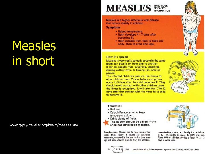 Measles in short www. gypsy-traveller. org/health/measles. htm. 