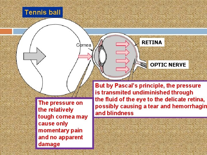 Tennis ball RETINA OPTIC NERVE The pressure on the relatively tough cornea may cause