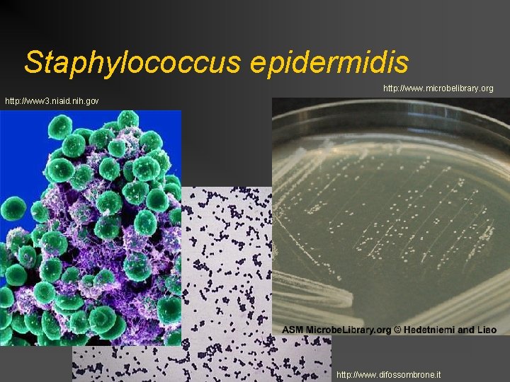 Staphylococcus epidermidis http: //www. microbelibrary. org http: //www 3. niaid. nih. gov http: //www.