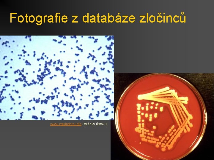 Fotografie z databáze zločinců www. medmicro. info (stránky ústavu) 