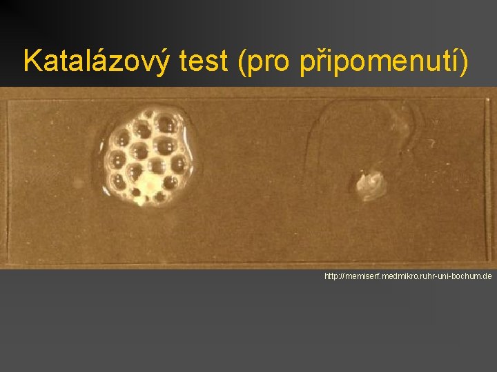 Katalázový test (pro připomenutí) http: //memiserf. medmikro. ruhr-uni-bochum. de 