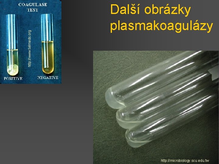 http: //www. telmeds. org Další obrázky plasmakoagulázy http: //microbiology. scu. edu. tw 