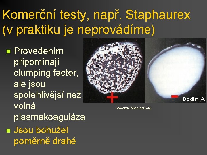 Komerční testy, např. Staphaurex (v praktiku je neprovádíme) n n Provedením připomínají clumping factor,