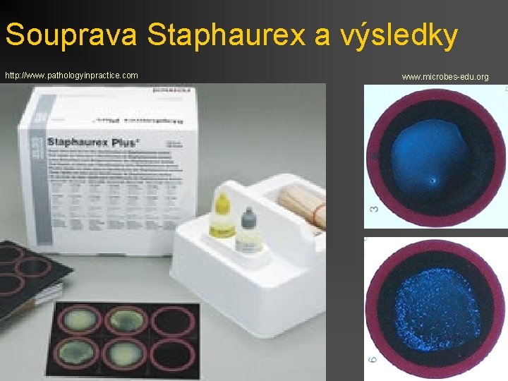 Souprava Staphaurex a výsledky http: //www. pathologyinpractice. com www. microbes-edu. org 