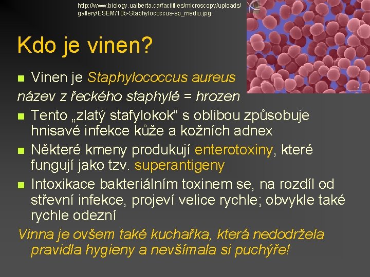 http: //www. biology. ualberta. ca/facilities/microscopy/uploads/ gallery/ESEM/10 b-Staphylococcus-sp_mediu. jpg Kdo je vinen? Vinen je Staphylococcus