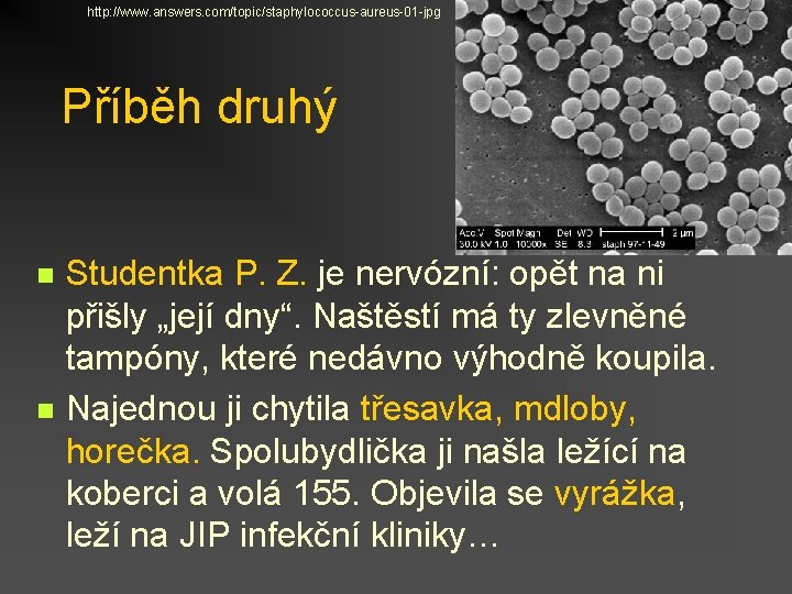 http: //www. answers. com/topic/staphylococcus-aureus-01 -jpg Příběh druhý n n Studentka P. Z. je nervózní: