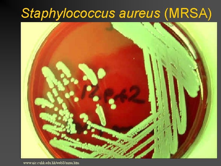 Staphylococcus aureus (MRSA) www. aic. cuhk. edu. hk/web 8/mrsa. htm 